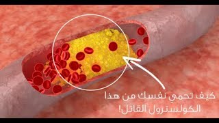 الاطعمة التي تساعد على تخفيض الكوليسترول | د. رالف عيراني