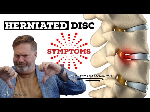Video: Kje se čuti bolečina zaradi hernije diska?