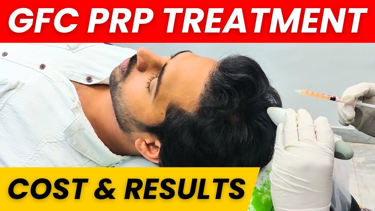 Going For My GFC PRP Treatment GFC Hair Treatment Results Cost going-for-my-gfc-prp-treatment-gfc-hair-treatment-results-cost