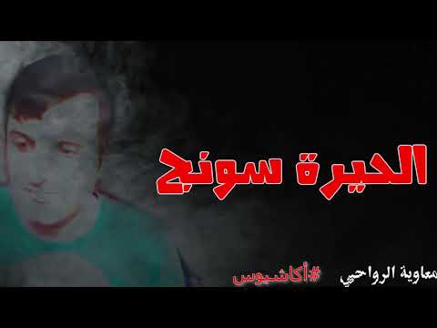 الحيرة سونج أكاشيوس