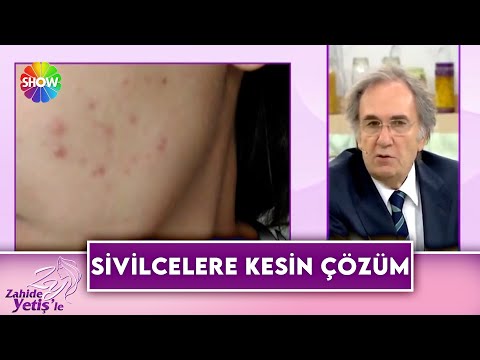 Prof. Dr. İbrahim Saraçoğlu'dan sivilce kürü!