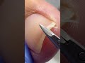 nail cleaning process #nailcare #pedicure #satisfying #nailtech #footcare #oddlysatisfying #fyp