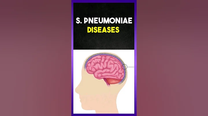 Diseases cause's by Streptococcus Pneumoniae