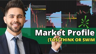 How To Set Up Market Profile On Think Or Swim