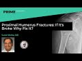 Proximal humerus fractures if its broke why fix it  samir mehta md
