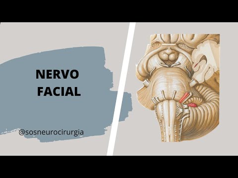 Vídeo: Paralisia Do Nervo Facial Em Cães