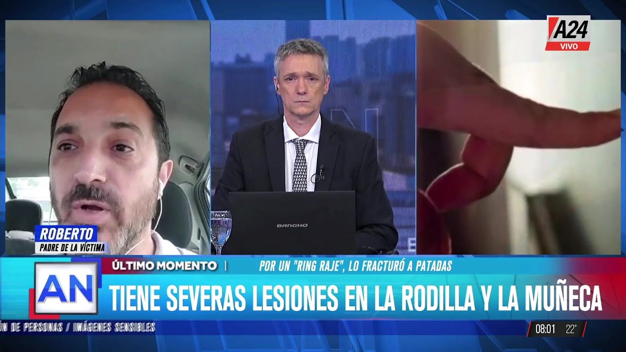 🔴LE FRACTURÓ LA MANO A UN NENE DE 11 AÑOS POR JUGAR AL 