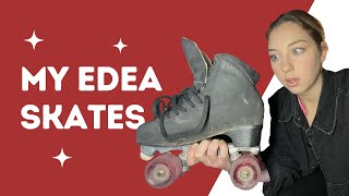 My Edea Skates | 1 year later...skate steroids, wackiness, & do I recommend Edea Skates for dance?!?