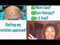 Tummy tuck revision approved! | How to talk to your surgeon about a revision | Tummy tuck journey!