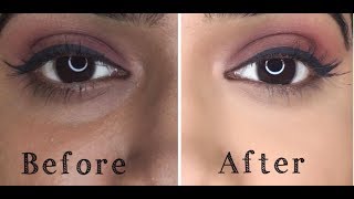HOW TO : COVER DARK CIRCLES!