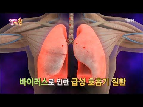 독감은 독하게 센 감기다?! 같은 듯 다른 질환! ＜독감 vs 감기＞