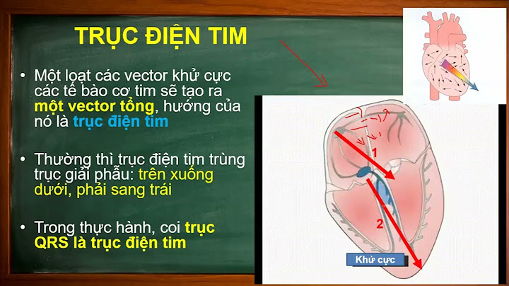 Ecg là viết tắt của từ gì năm 2024