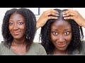 The Right Way To Moisturize Your Scalp || Grow Thin Fine Natural Hair Thick || Adede