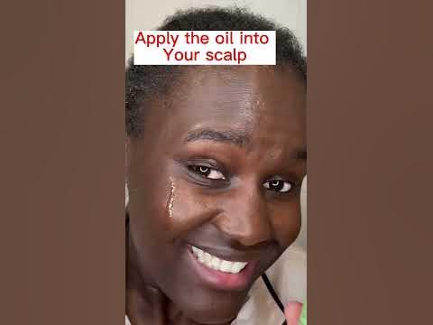 How I grew back my Hairline🤯/Mielle Rosemary Mint oil Before and After