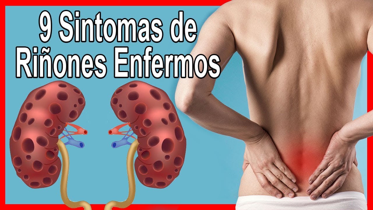 Quem Tem Problema Renal Pode Tomar Dipirona ??Si tienes alguno de estos 9 Síntomas ?? Puedes Padecer de algún