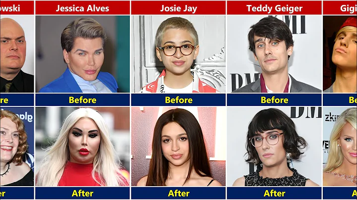 Celebrities Who Underwent Gender Transition | Before and After