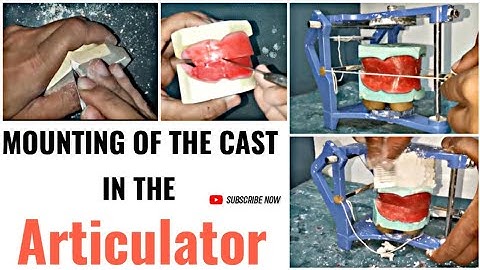 Mounting on articulator ||mean value articulator|| Dr Raj Dentistry||