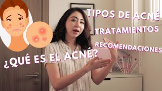 ¿QUÉ ES EL ACNÉ? Todo sobre clasificación, tratamientos, faciales y más!