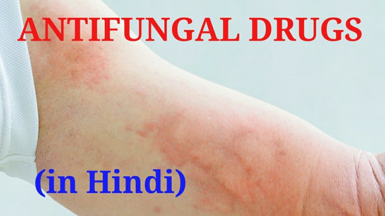 antifungal drugs antifungal drugs chemistry antifungal drugs in