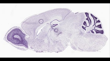 mouse brain - P56 sagittal