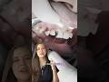 Tratamiento de conducto #endodoncia #caries #cariesdental #viral #greenscreen #dentist #dientes