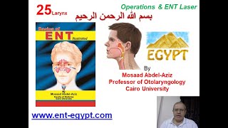 Larynx 5 (Mosaad Abdel-Aziz): Operations of the Larynx [Tracheostomy] & ENT LASER