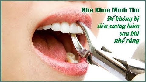 GHÉP XƯƠNG - Để không bị tiêu xương hàm sau khi nhổ răng - NhaKhoaMinhThu