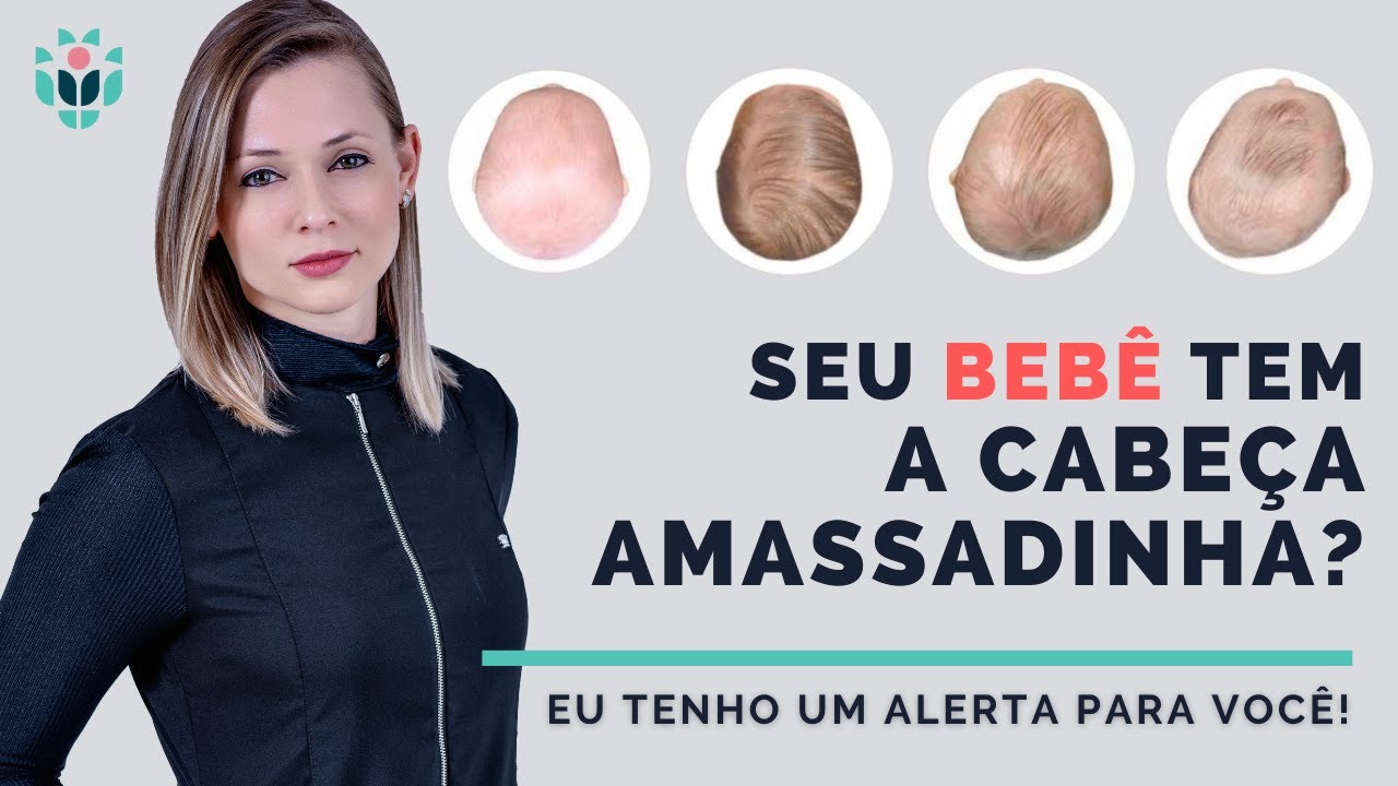 BEBÊ COM A CABEÇA AMASSADA É NORMAL? - YouTube
