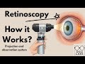 How Retinoscopy Works: Projection and Observation system | Optometry | Opthalmology