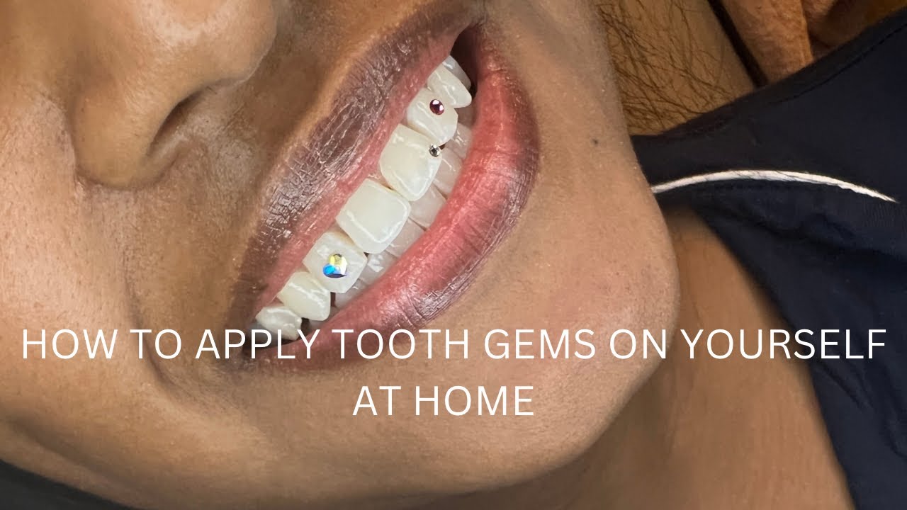 How to Start your own Tooth Gems Business- Application Steps and