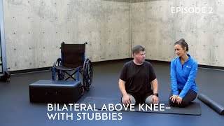 Bilateral Above Knee – with Stubbies
