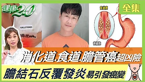 食道癌 膽管癌超凶險 早期無症狀！喝酒臉紅恐食道癌 膽結石反覆發炎易癌變！ 健康2.0 20230527【完整版】鄭凱云 許秉毅 劉文山 黃淑惠 陳麗華 王明勇 @tvbshealth20 - 天天要聞