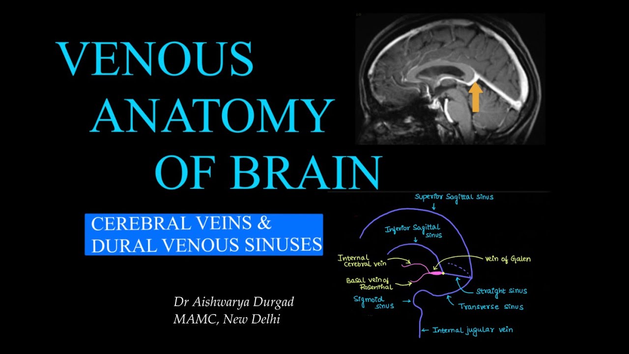 CEREBRAL VENOUS ANATOMY L RADIOLOGY L DURAL VENOUS SINUSES L CEREBRAL CEREBRAL VENOUS ANATOMY L RADIOLOGY L DURAL VENOUS SINUSES L CEREBRAL