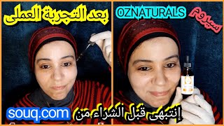 سيروم فيتامين سى oznaturals وهل سيروم فيتامين سى اوز ناتشورال اصلى ولا؟؟؟؟؟؟