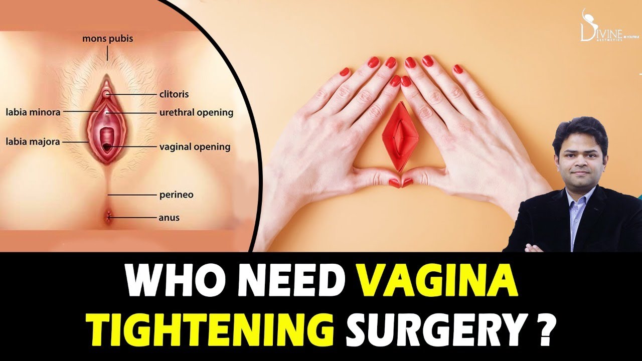 Pornstar Vagina Surgery