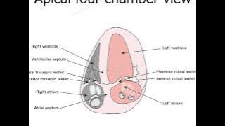 24. Measurement of tricuspid annular plane systolic excursion (TAPSE)