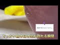 【足裏に穴?】どデカい魚の目の芯が取れる瞬間1【世田谷区用賀】フットケア#魚の目#鶏眼