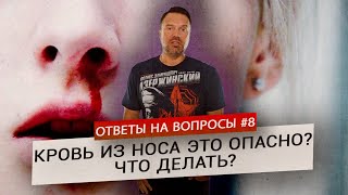видео: Кровь из носа – в чем причина? Что делать? (Ответы на Вопросы) картинка: Кровь из носа – в чем причина? Что делать? (Ответы на Вопросы)