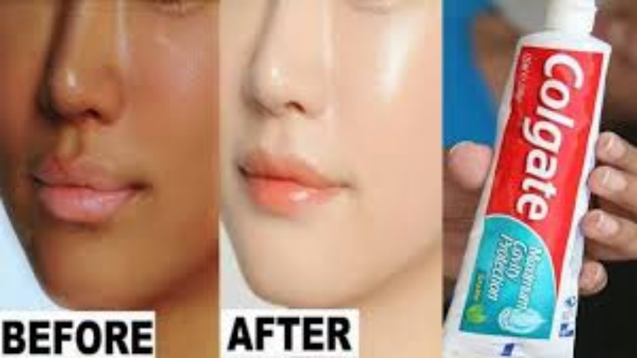 Dark spots treating with toothpast چہرے کے داغ دھبے اور چھائیوں سے