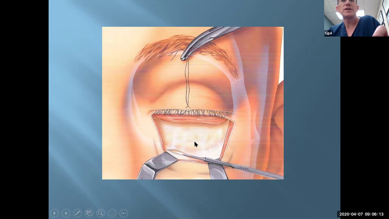 Approaches to the facial skeleton - Dr. TJ Gal - YouTube