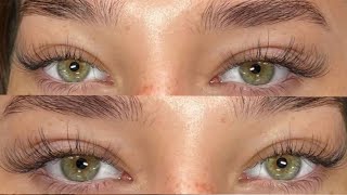 Experimental Eye Melanin Reduction & Light Green Eyes ୨୧