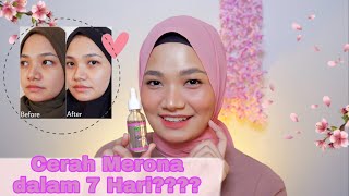 QNA SERUM VIT.C DAN REVIEW GARNIER LIGHT COMPLETE VITAMIN C 30X BOOSTER SERUM