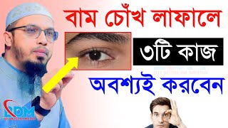 🔴বাম চোঁখ লাফালে ৩টি কাজ অবশ্যই করবেন।শায়খ আহমাদুল্লাহ।Shaykh Ahmadullah.May 9,8:30 AMe5aewr243ri86