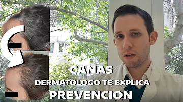 ¿Cómo evitar las canas si soy joven?