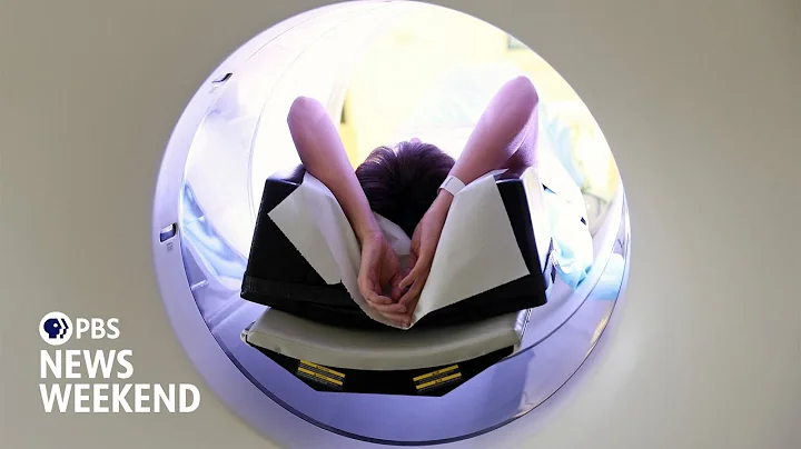 Study shows link between CT scans and the risk of developing cancer