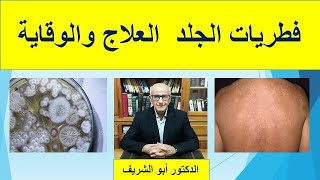 فطريات الجلد العلاج والوقاية