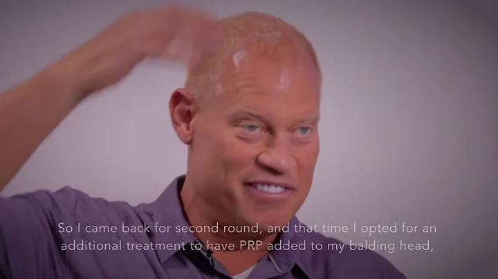 JASON PRATTE   Hair loss Stem Cells Treatment