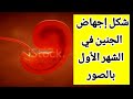شكل إجهاض الجنين في الشهر الأولشكل الجنين إذا سقط في الشهر الأول بالصورالجنين في الاسبوع الاول mp3