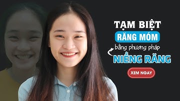 Cảm nhận kết quả niềng răng móm của bạn Anh Thơ - Nha Khoa LINH XUÂN