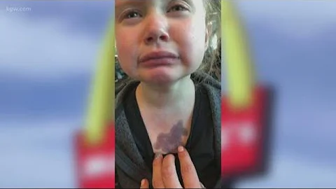 Toddler burned by scalding water PDX McDonald's put into a thermos